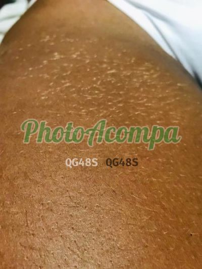 Ayana, escort em Recife
