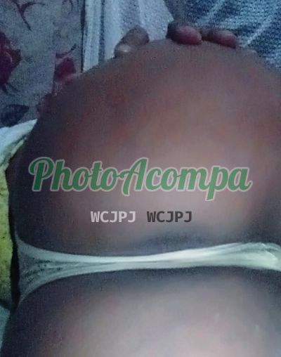 Bruninha, acompanhante em Messejana (Fortaleza)