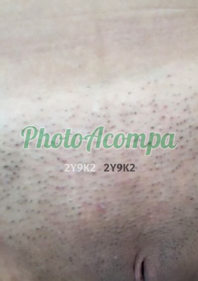Dafiny Lira, escort em Ipojuca