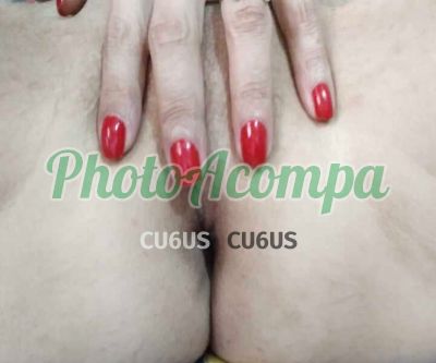 Renatinha Vogue (11) 97346-1845, trans em Atibaia