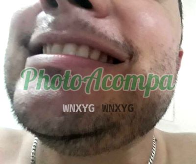 Lorenzo (11) 94021-9275, garoto de programa na Zona Leste (SP)