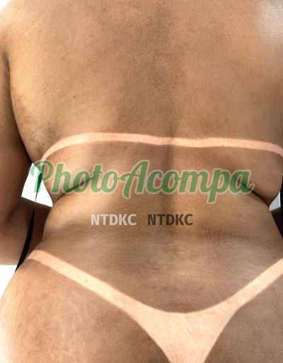 Mulher Melancia (51) 98938-9479, acompanhante em São Leopoldo