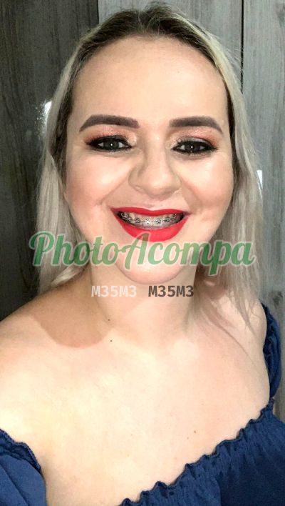Massagista (54) 99319-5574, acompanhante em Caxias do Sul