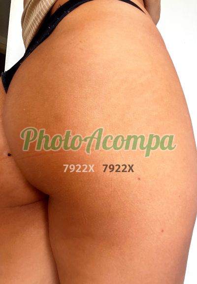Aninha (38) 98862-5047, garota de programa em Patrocínio