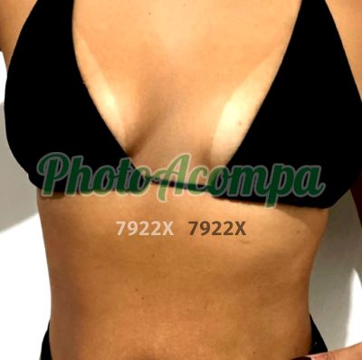 Aninha (38) 98862-5047, escort em Patrocínio